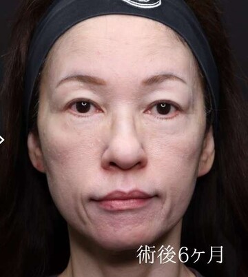 聖心美容クリニックの症例写真[アフター]