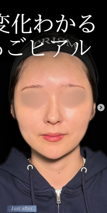 PRISM Beauty Clinicの症例写真[アフター]