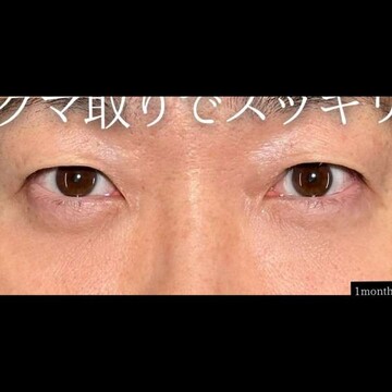 PRISM Beauty Clinicの症例写真[アフター]