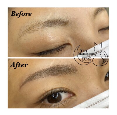 ナチュラル眉 眉のアートメイクの症例写真 画像 女性医療クリニックluna Cs 美容医療の口コミ広場