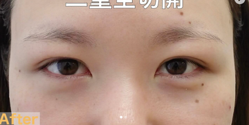 さかえ皮フ科クリニック（旧：ニドークリニック名古屋）の症例写真[アフター]