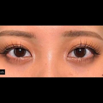 PRISM Beauty Clinicの症例写真[アフター]