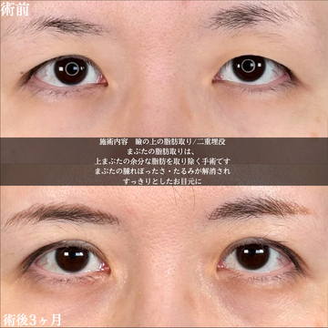 アリエル美容クリニック 大宮院の二重の症例写真