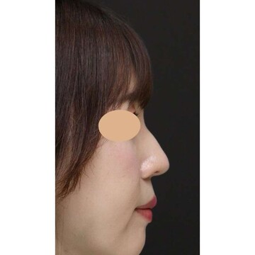 聖心美容クリニックの症例写真[アフター]