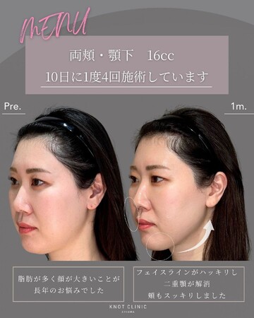 KNOT CLINIC AOYAMAの痩身、メディカルダイエットの症例写真