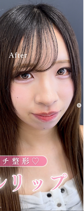 ルラ（LULA）美容クリニックの症例写真[アフター]