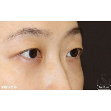 聖心美容クリニックの症例写真[アフター]