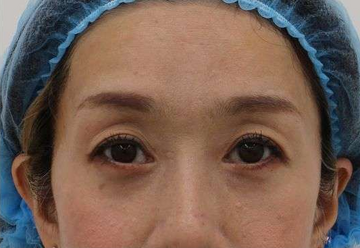 すなおクリニックの症例写真[アフター]