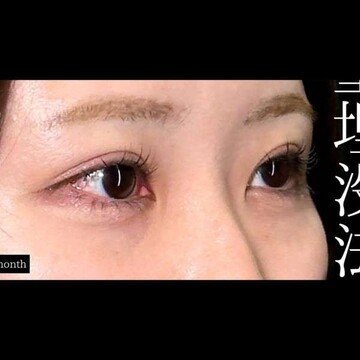 PRISM Beauty Clinicの症例写真[アフター]