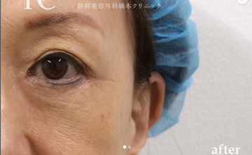 静岡美容外科橋本クリニックの症例写真[アフター]