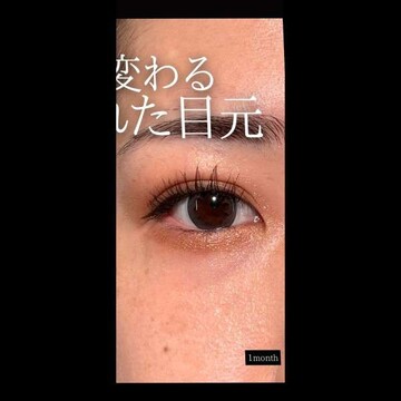 PRISM Beauty Clinicの症例写真[アフター]