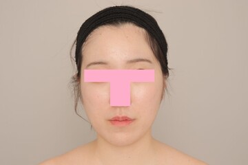 Mods Clinic (モッズクリニック)の症例写真[アフター]