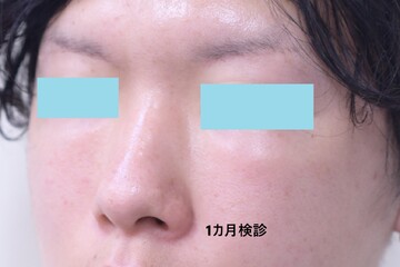 医療法人秀晄会 心斎橋コムロ美容外科クリニックの症例写真[アフター]