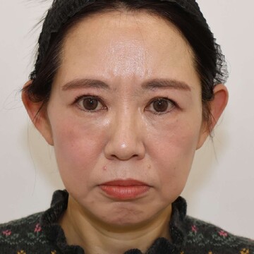 すなおクリニックの症例写真[アフター]
