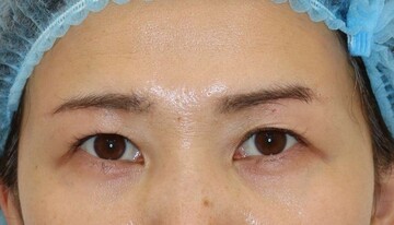 すなおクリニックの症例写真[アフター]