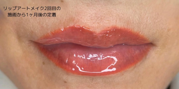 医療法人美戸会　かなえデンタルクリニックの症例写真[アフター]