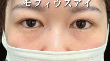 Plume Clinicの症例写真[アフター]