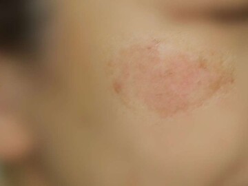 船橋ゆーかりクリニックの症例写真[アフター]