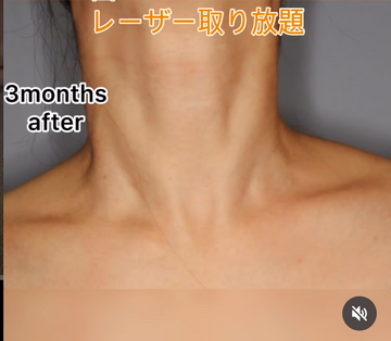 みやもと美容クリニックの症例写真[アフター]