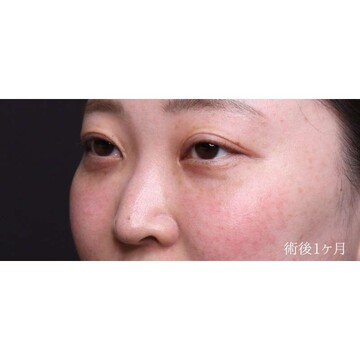 聖心美容クリニックの症例写真[アフター]