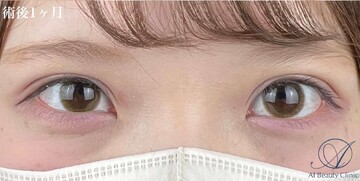 AI Beauty Clinicの症例写真[アフター]