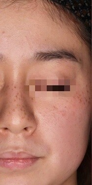 Select Clinic セレクトクリニック 表参道院の症例写真 美容医療の口コミ広場