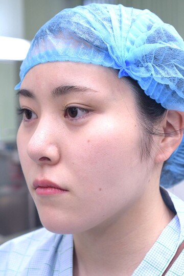 医療法人秀晄会 心斎橋コムロ美容外科クリニックの輪郭・顎・エラ・額・小顔整形の症例写真[ビフォー]