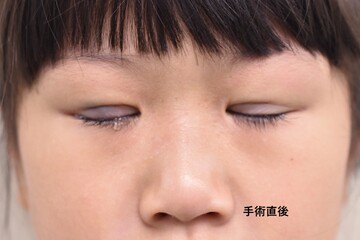 医療法人秀晄会 心斎橋コムロ美容外科クリニックの症例写真[アフター]