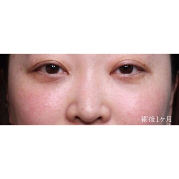 聖心美容クリニックの症例写真[アフター]