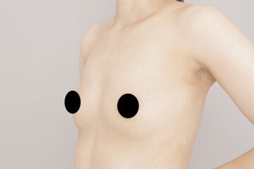 Mods Clinic (モッズクリニック)の豊胸・胸の整形の症例写真[ビフォー]