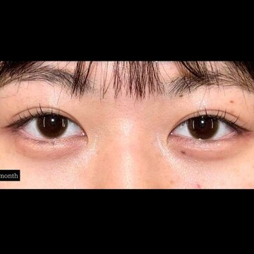 PRISM Beauty Clinicの症例写真[アフター]
