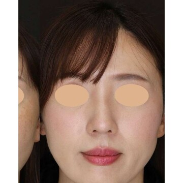 聖心美容クリニックの症例写真[アフター]