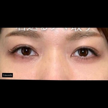 PRISM Beauty Clinicの症例写真[アフター]