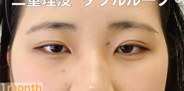 さかえ皮フ科クリニック（旧：ニドークリニック名古屋）の症例写真[アフター]