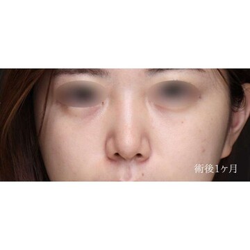 聖心美容クリニックの症例写真[アフター]