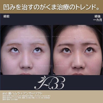 20代のくま治療
の症例写真