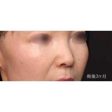 聖心美容クリニックの症例写真[アフター]