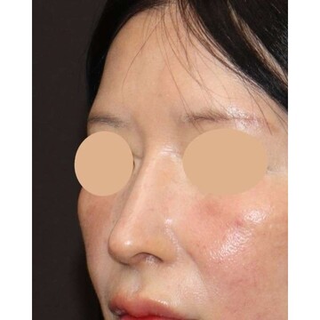 聖心美容クリニックの症例写真[アフター]