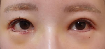 Plume Clinicの症例写真[アフター]