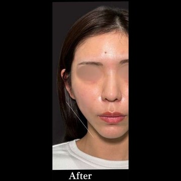 PRISM Beauty Clinicの症例写真[アフター]
