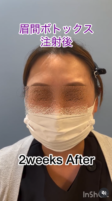 みやもと美容クリニックの症例写真[アフター]
