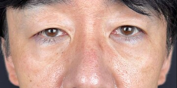 AI Beauty Clinicの症例写真[アフター]