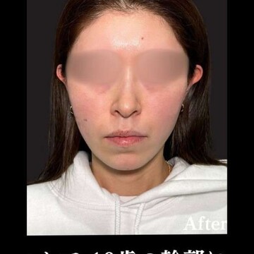 PRISM Beauty Clinicの症例写真[アフター]