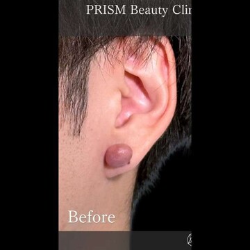 PRISM Beauty Clinicのその他の美容医療の症例写真[ビフォー]