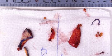 医療法人秀晄会 心斎橋コムロ美容外科クリニックの症例写真[アフター]