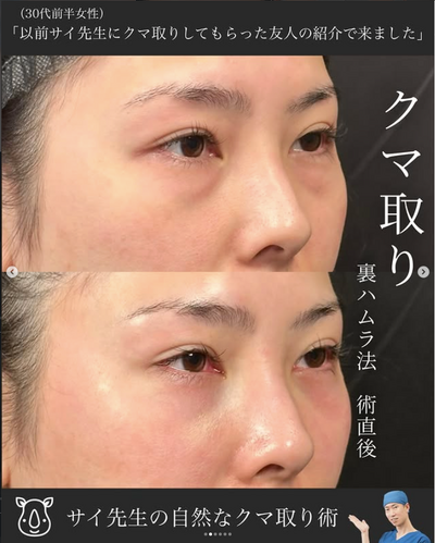 裏ハムラの症例写真