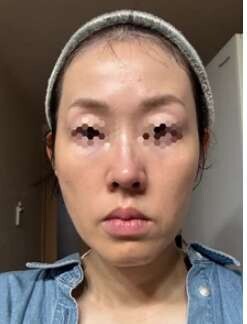 ペルラクリニック神宮前の症例写真[アフター]