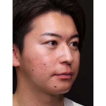 聖心美容クリニックの症例写真[アフター]