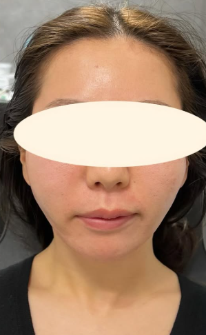Plume Clinicの症例写真[アフター]