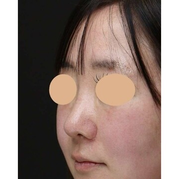 聖心美容クリニックの症例写真[アフター]